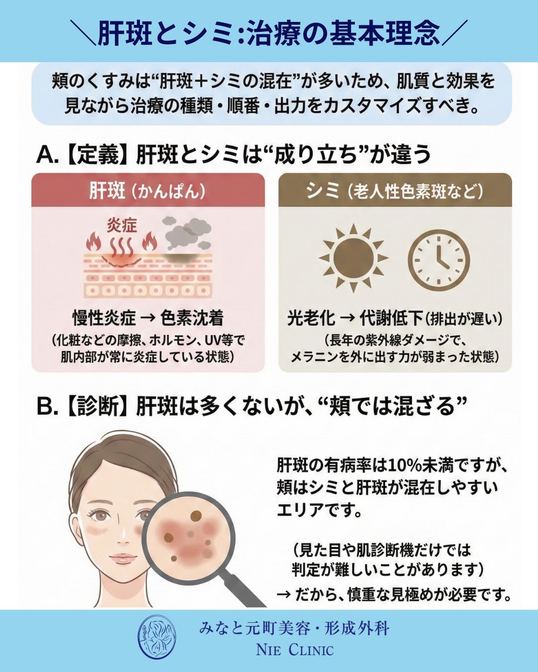 肝斑とシミの見極め