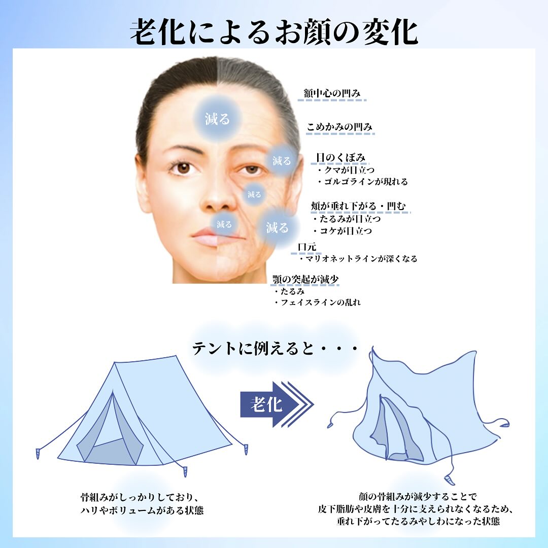 《アンチエイジングの治療にヒアルロン酸は必要なのか》