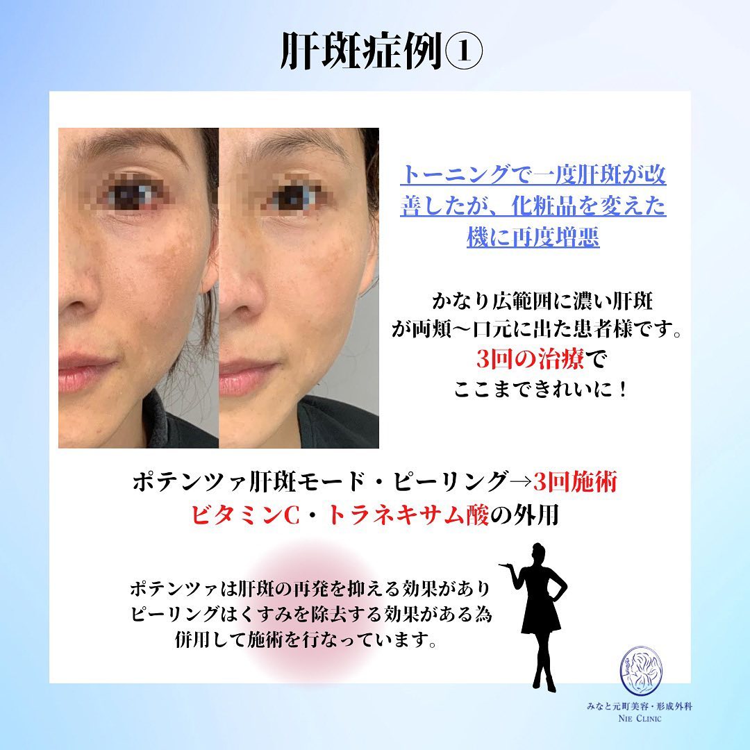 Instagram転載記事