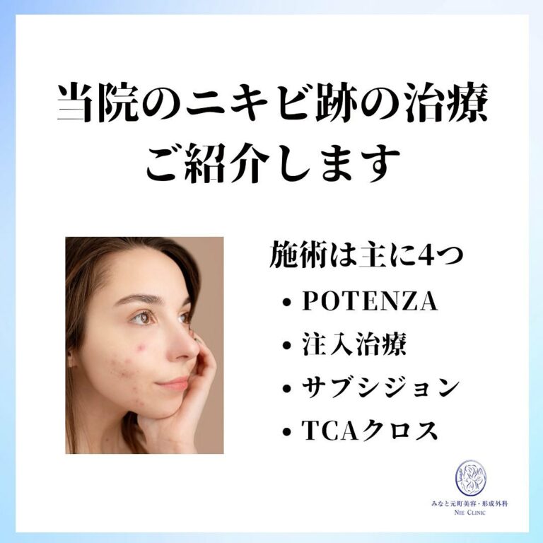 instagram-01-304
