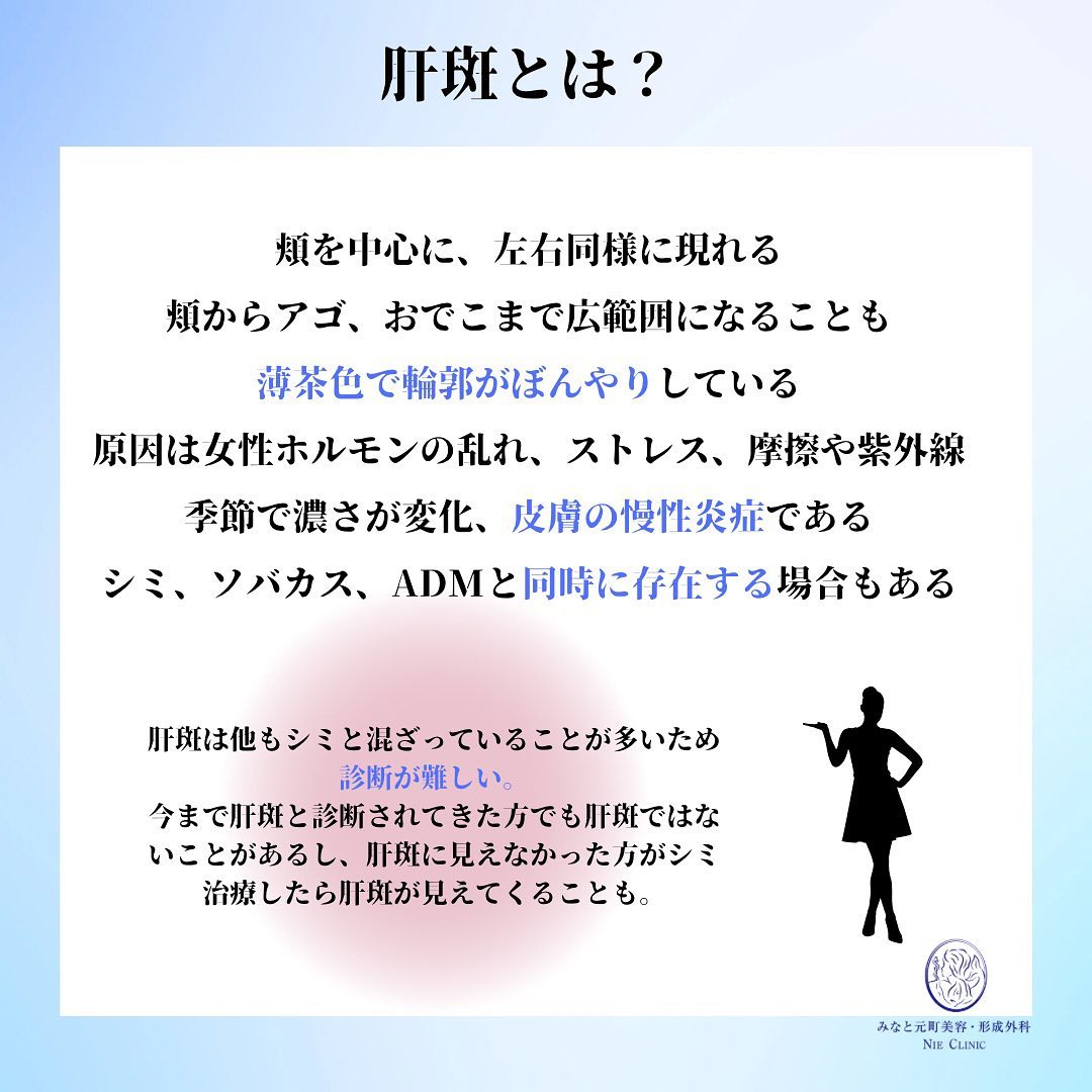 ポテンツァ肝斑治療