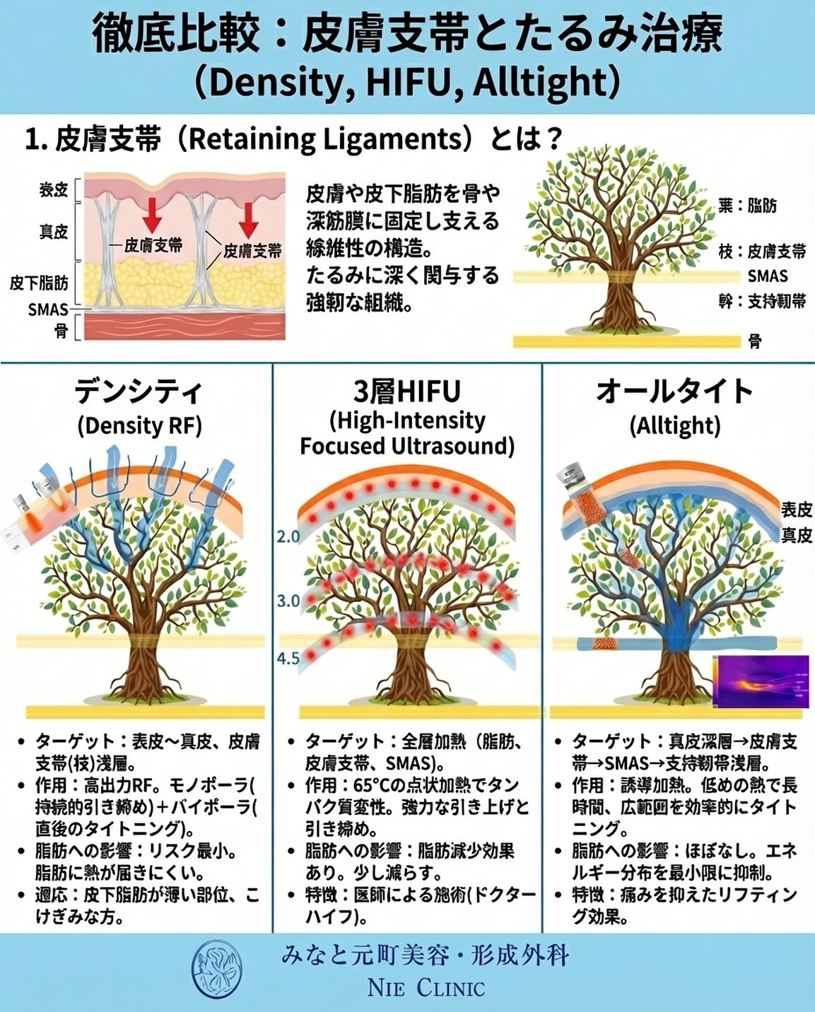 たるみ治療で使われるRF・HIFU・Alltiteの比較イラストになります。