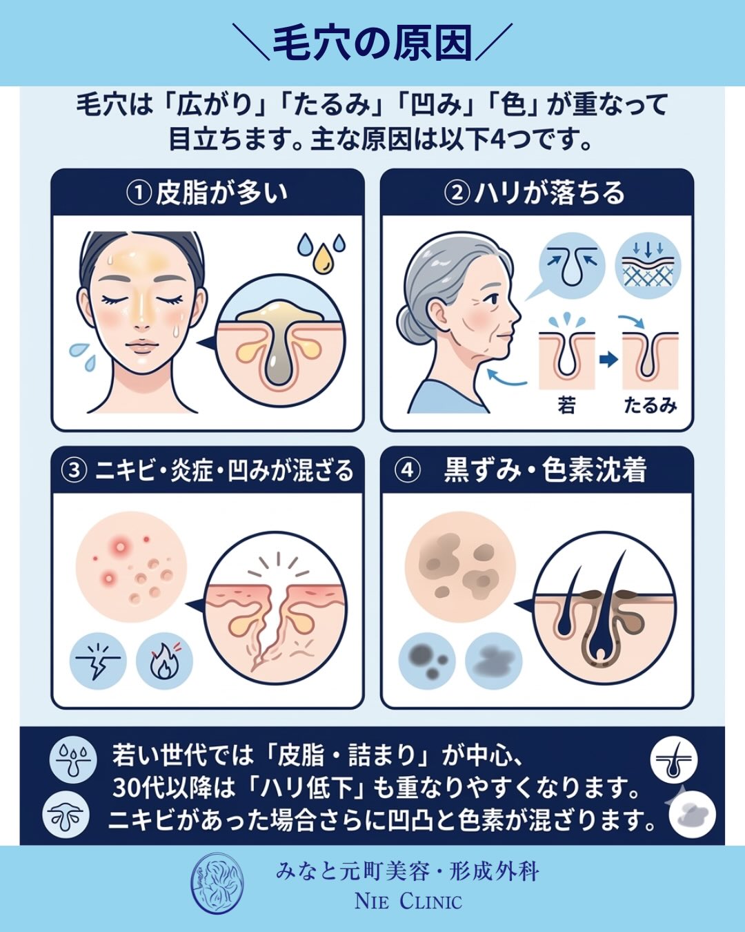 毛穴の悩み、実はタイプが違います！正しい治療法、選べていますか？🤔