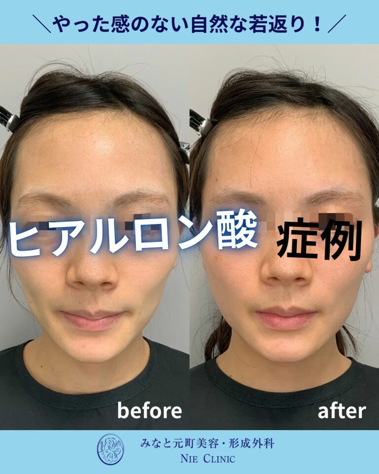 instagram-01-374