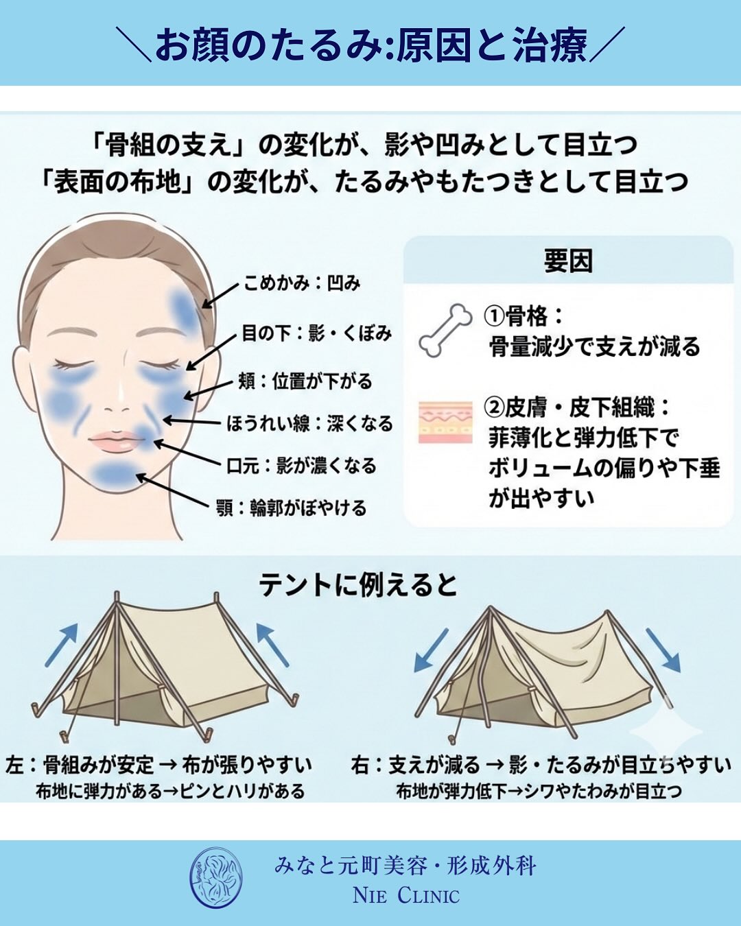 たるみ治療の考え方