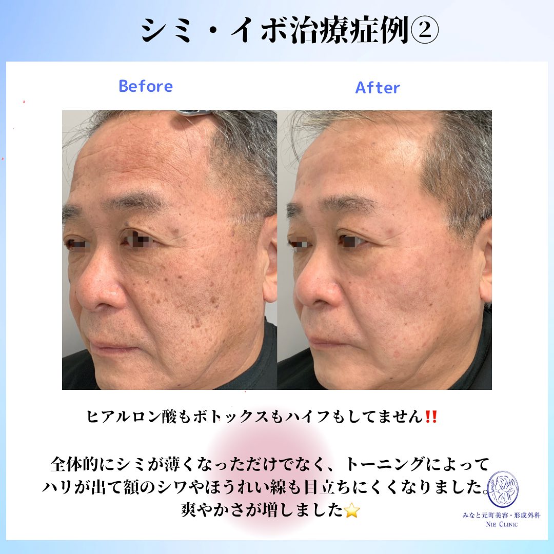 《何歳でも始められる肌治療》
