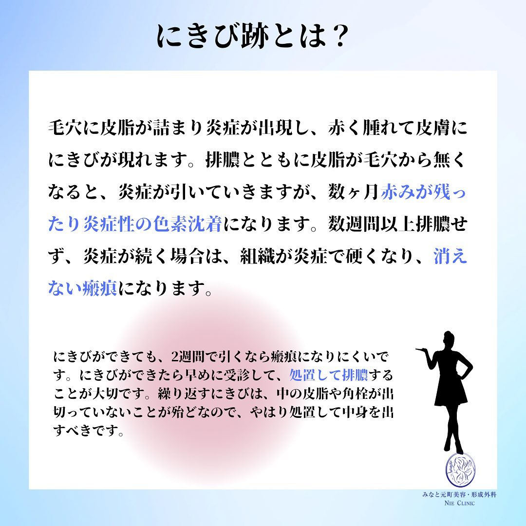 当院のにきび跡の治療