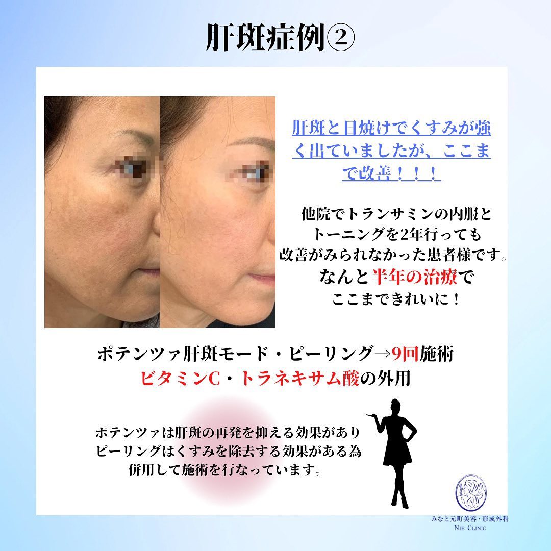 Instagram転載記事