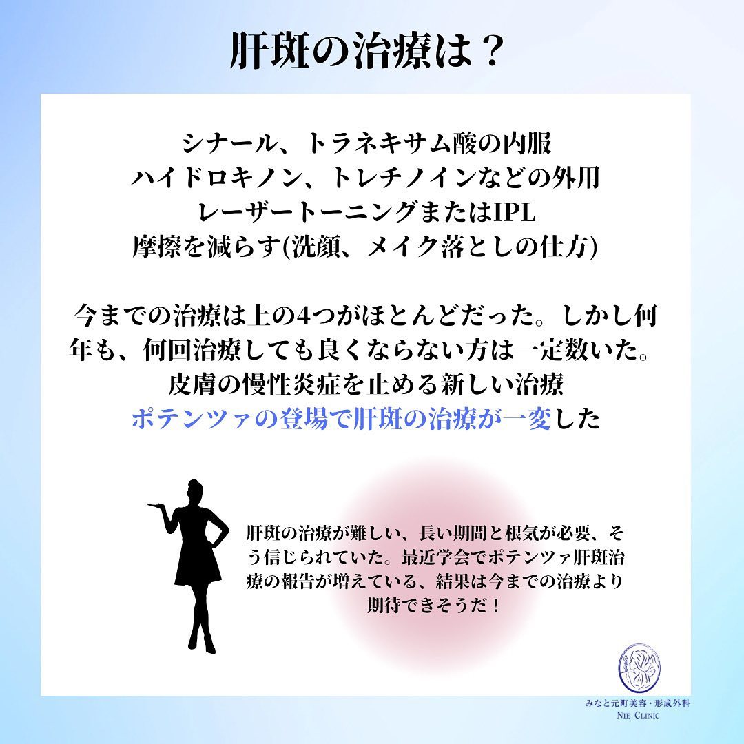 ポテンツァ肝斑治療