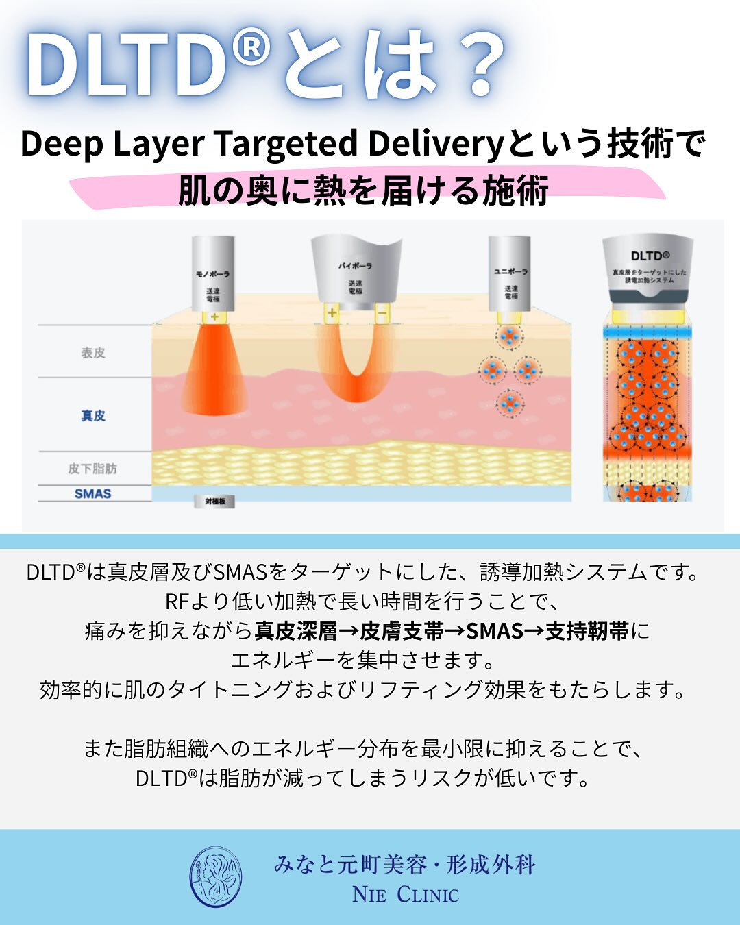 Alltite導入のお知らせ