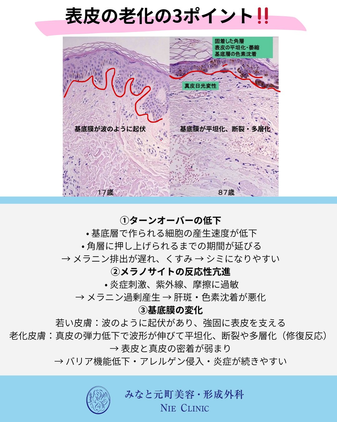 肌老化のメカニズム