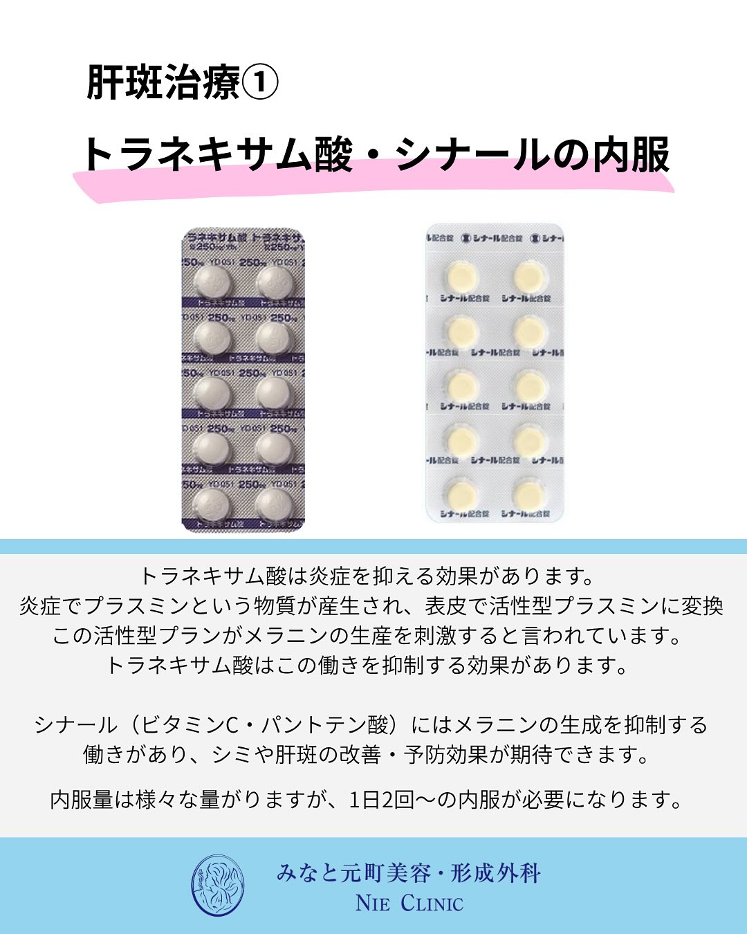 肝斑の特徴と治療紹介