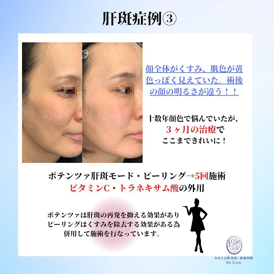 Instagram転載記事