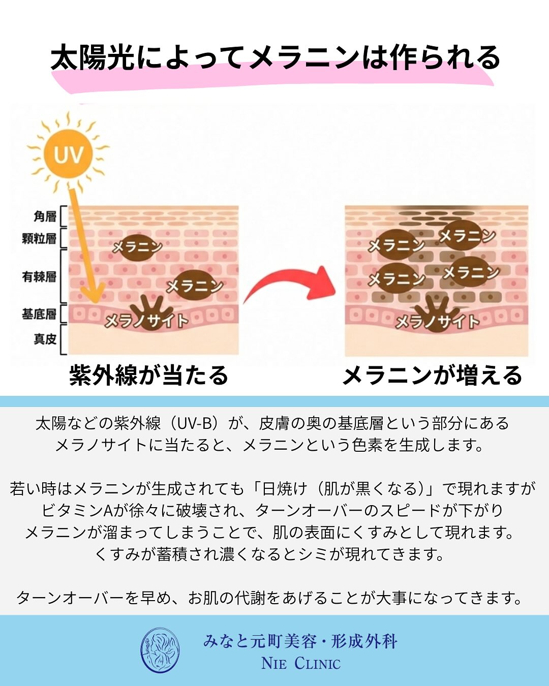 光老化と肌変化の関係