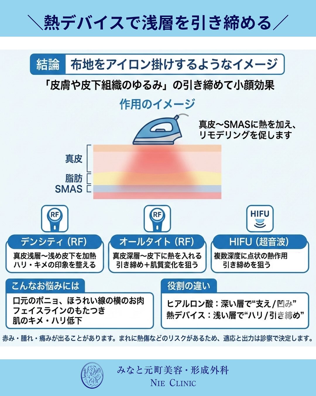 たるみ治療の考え方