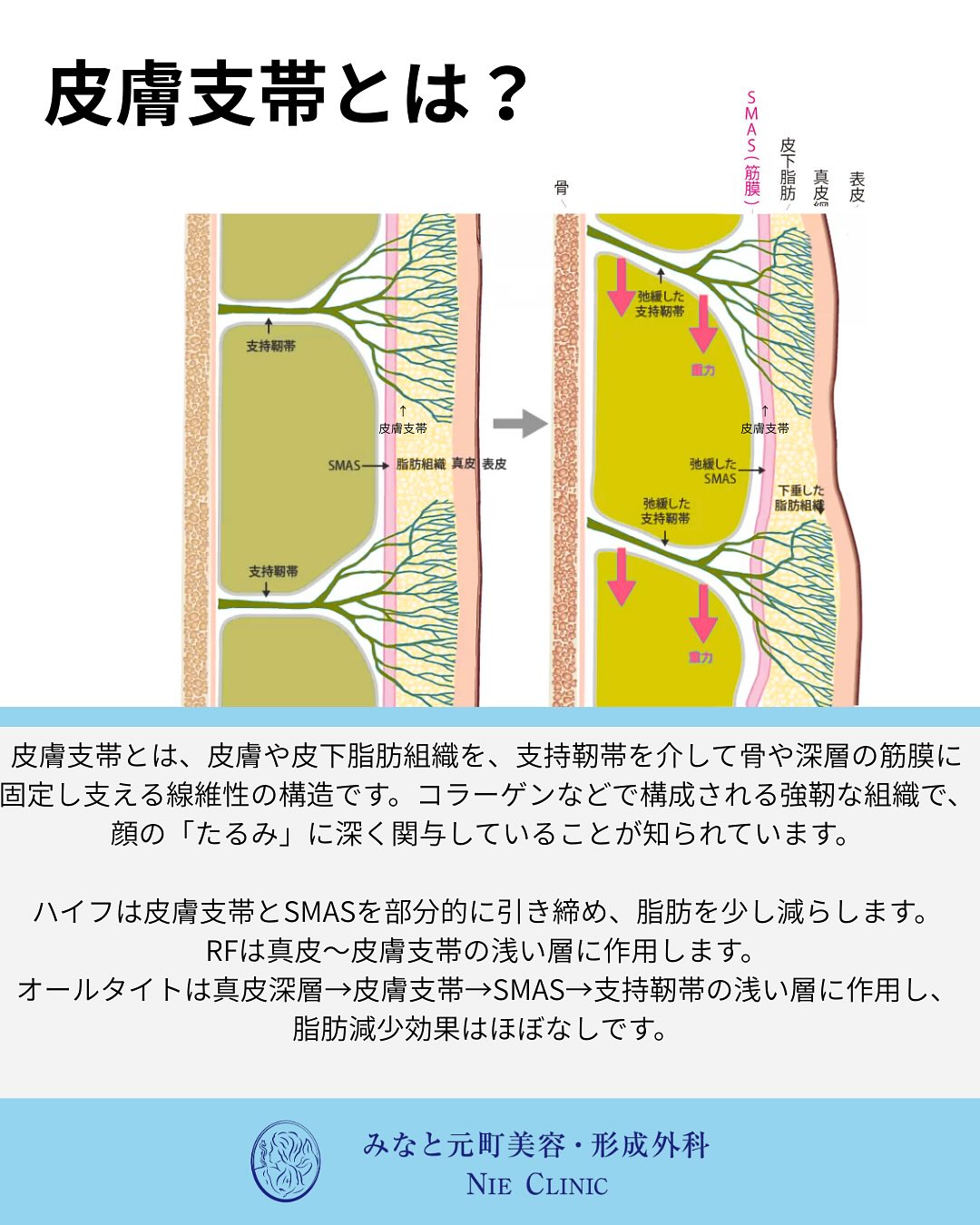 Alltite導入のお知らせ