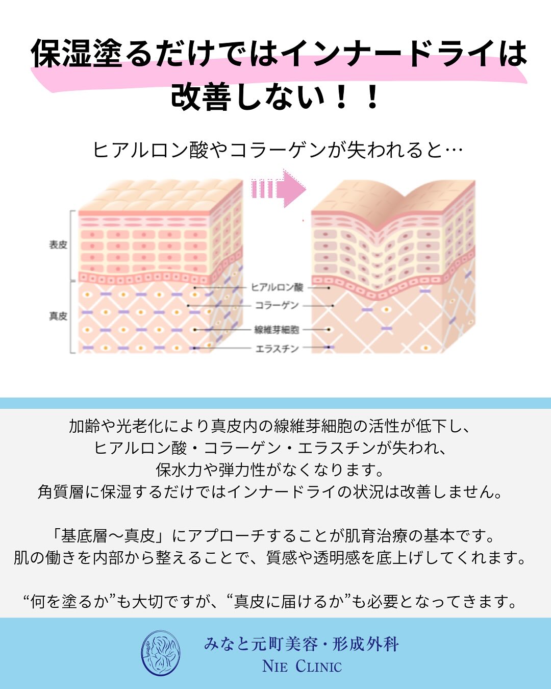 メソナJのご紹介