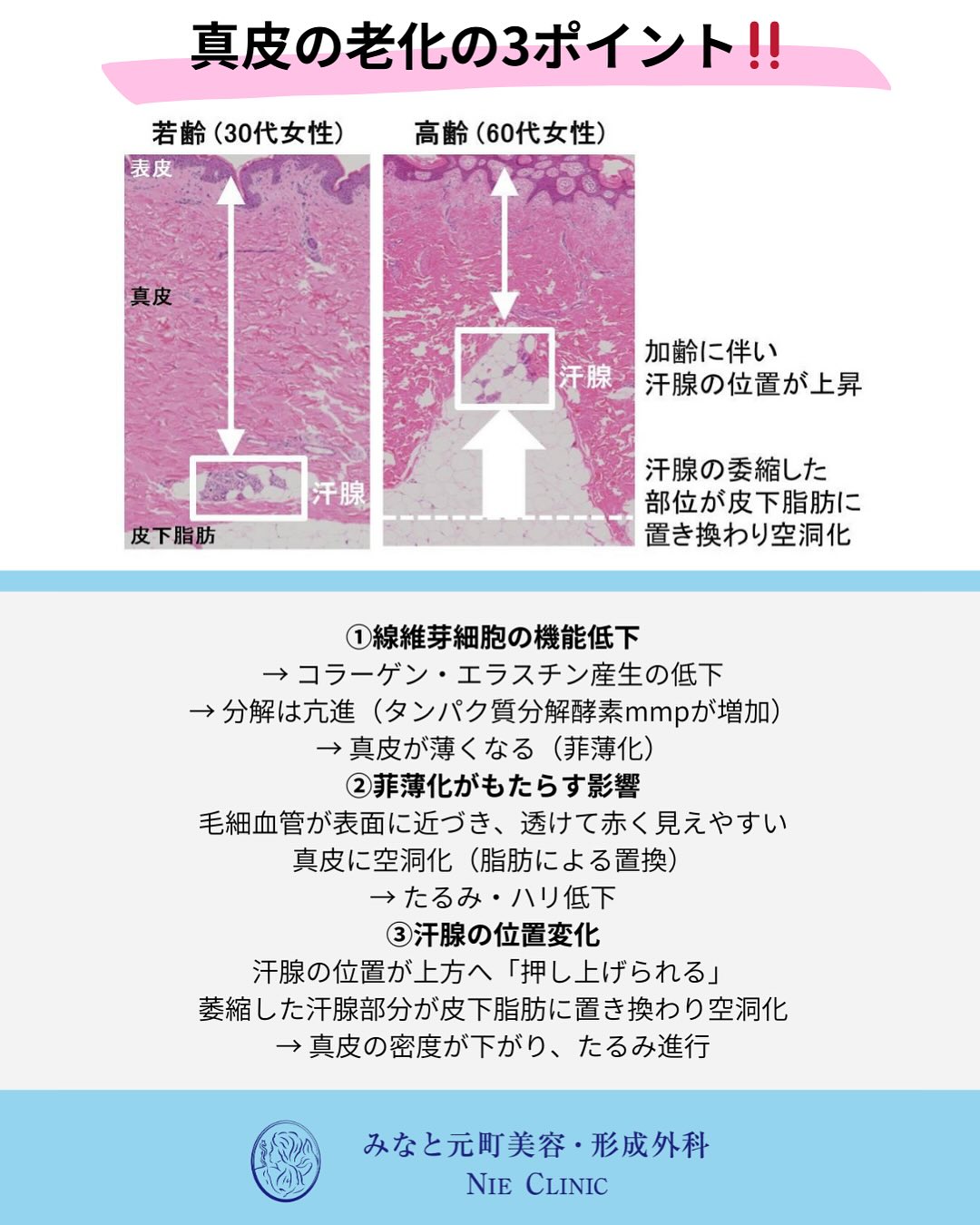肌老化のメカニズム
