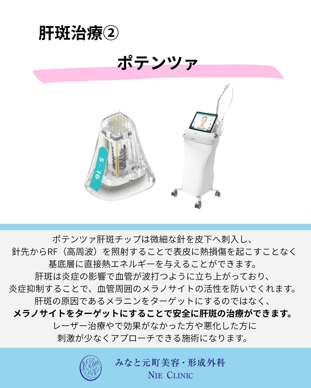 肝斑の特徴と治療紹介