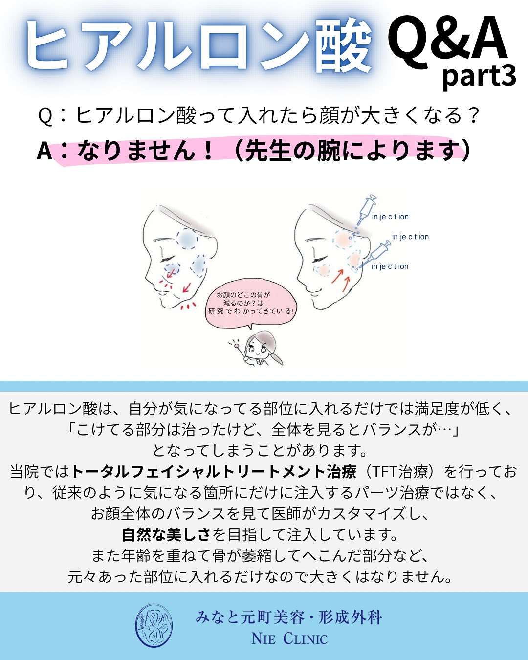 ヒアルロン酸のよくある質問