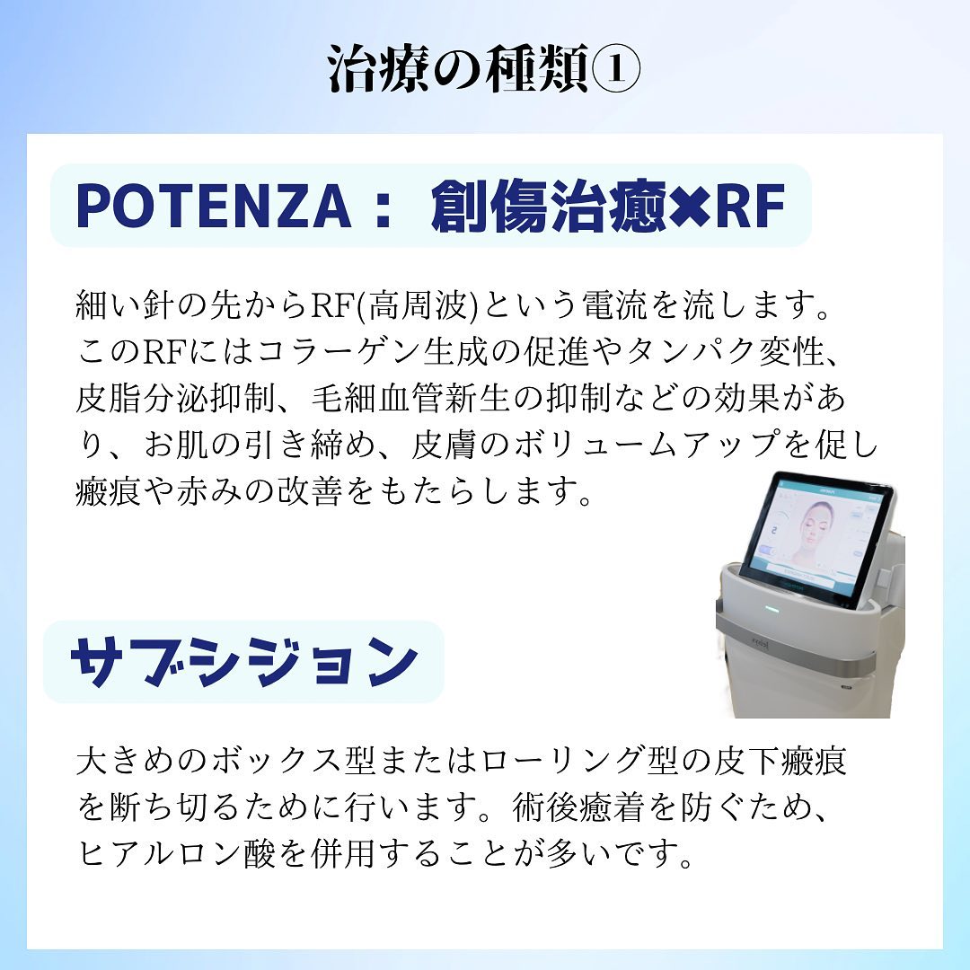 当院のにきび跡の治療