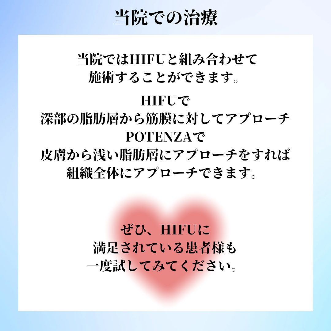 💎ポテンツァのダイヤモンドチップ💎