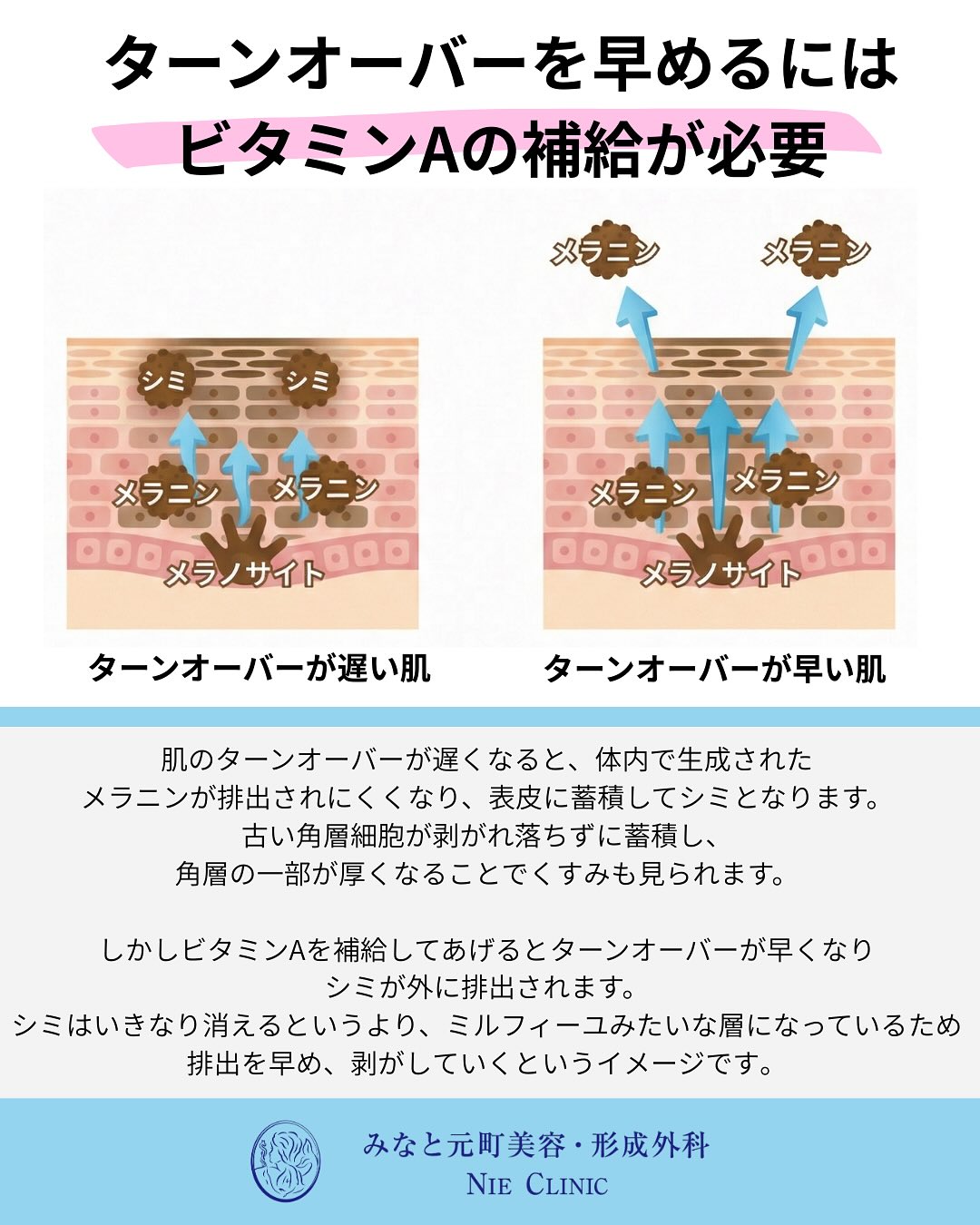 光老化と肌変化の関係