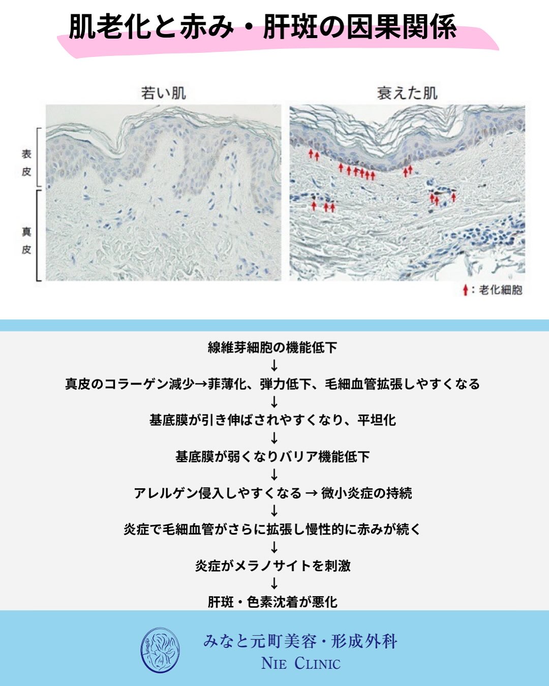 肌老化のメカニズム