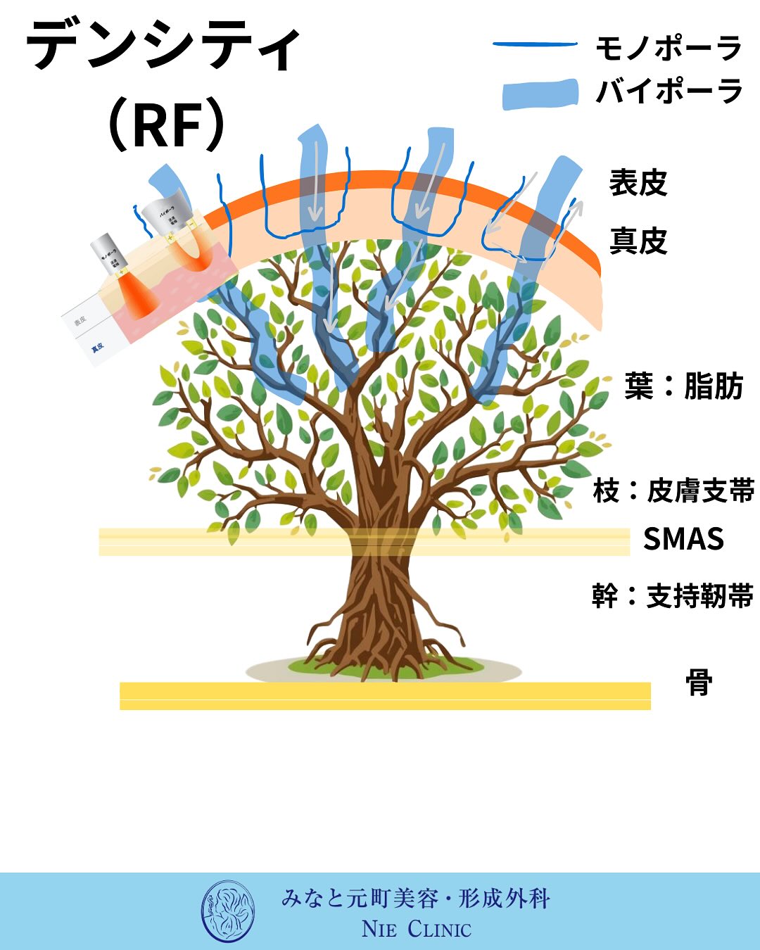 Alltite導入のお知らせ