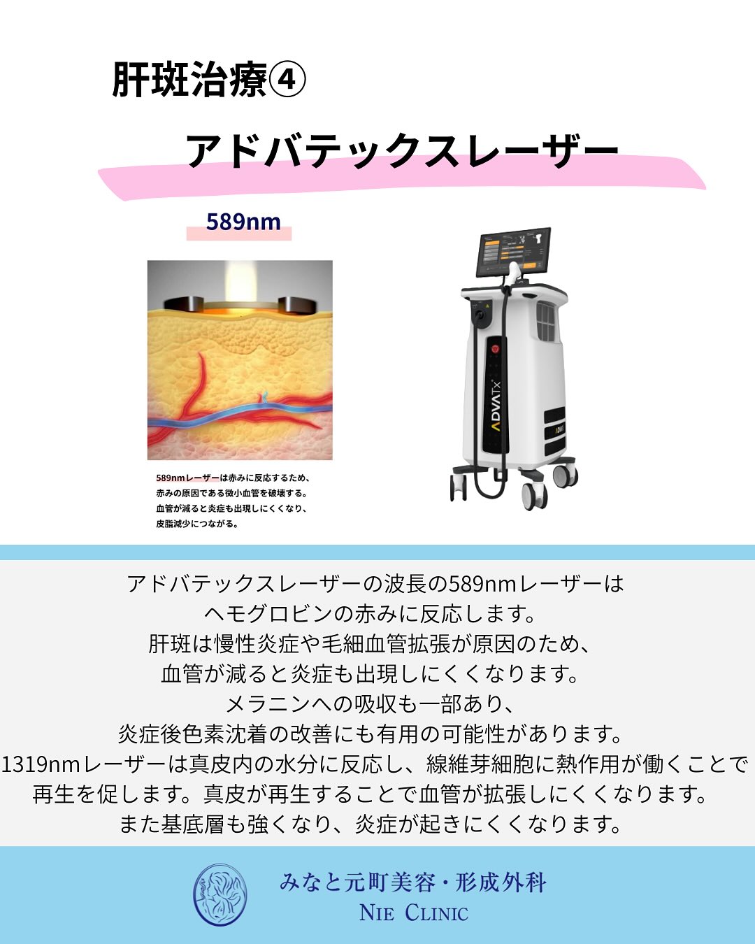 肝斑の特徴と治療紹介