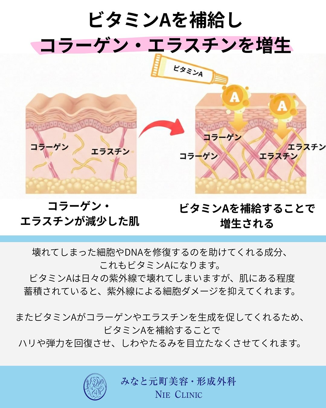 光老化と肌変化の関係