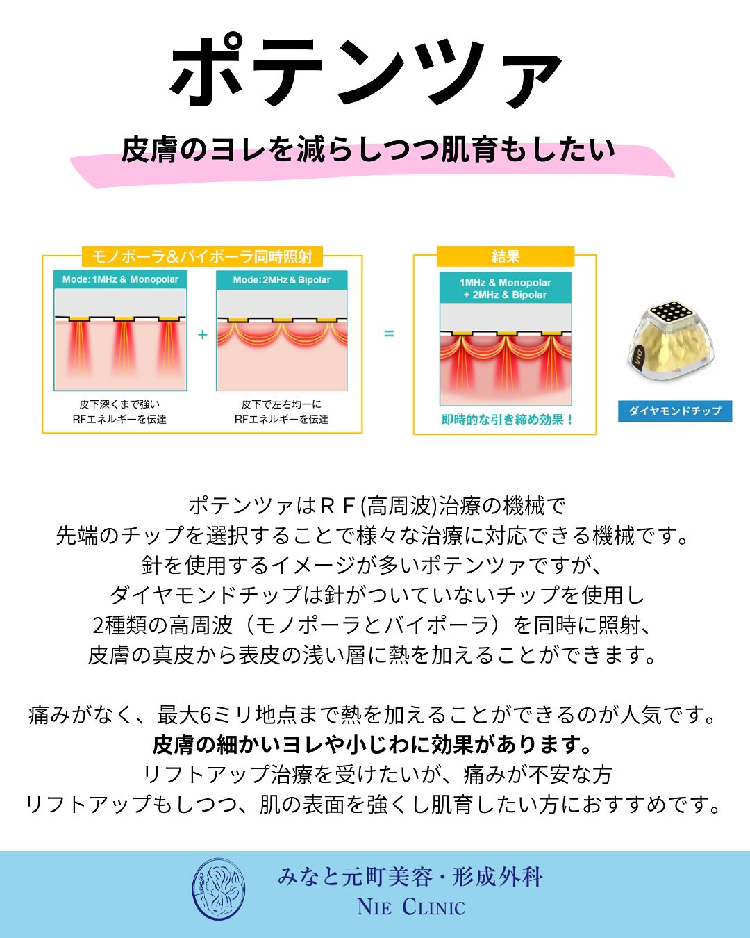 たるみ治療の比較
