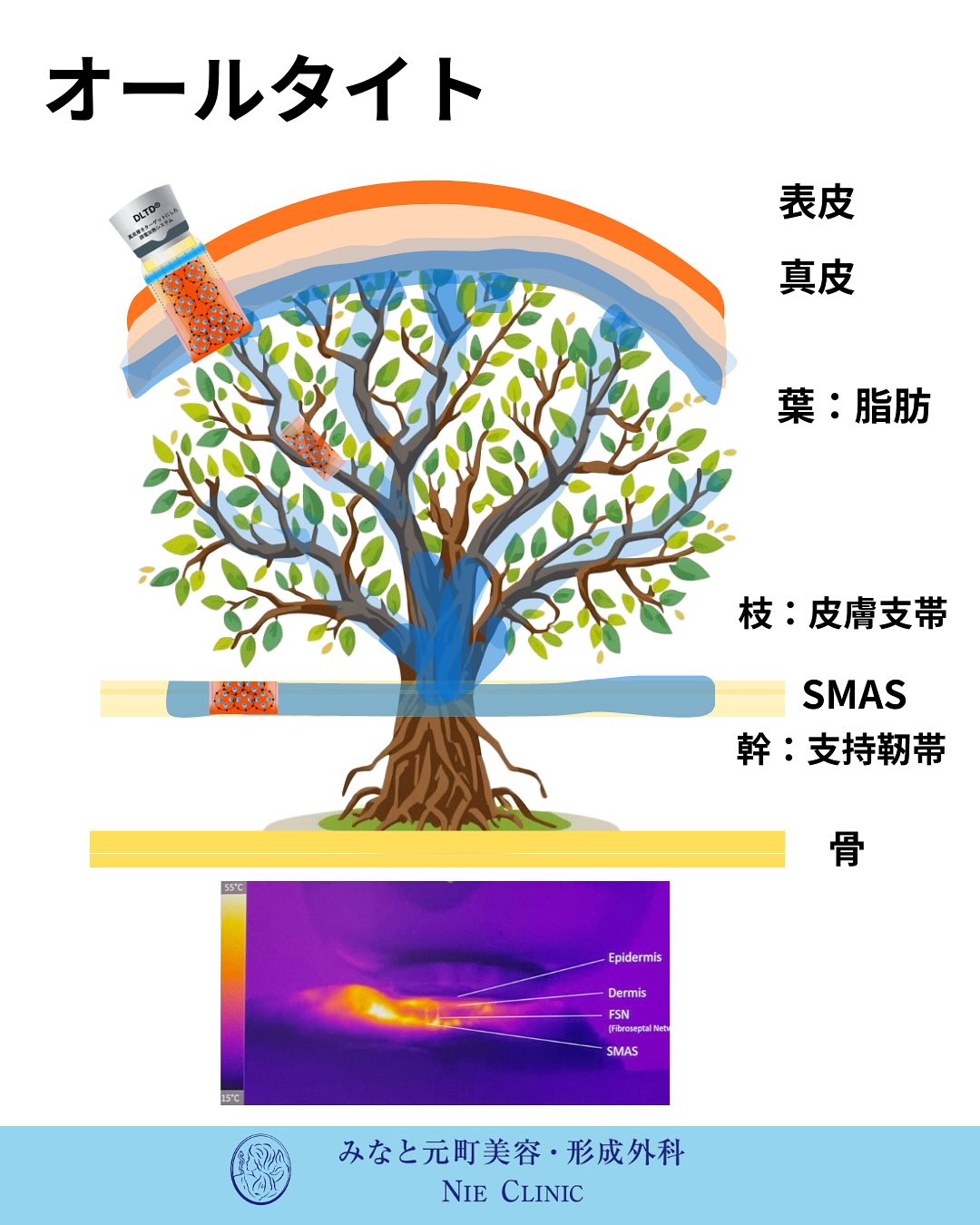 Alltite導入のお知らせ