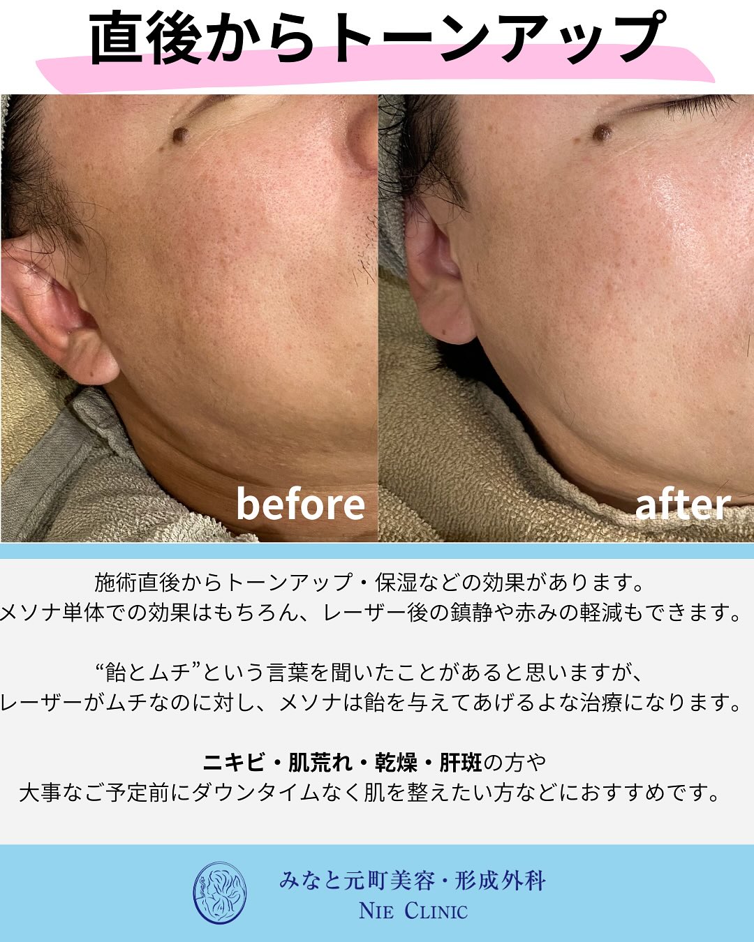 メソナJのご紹介