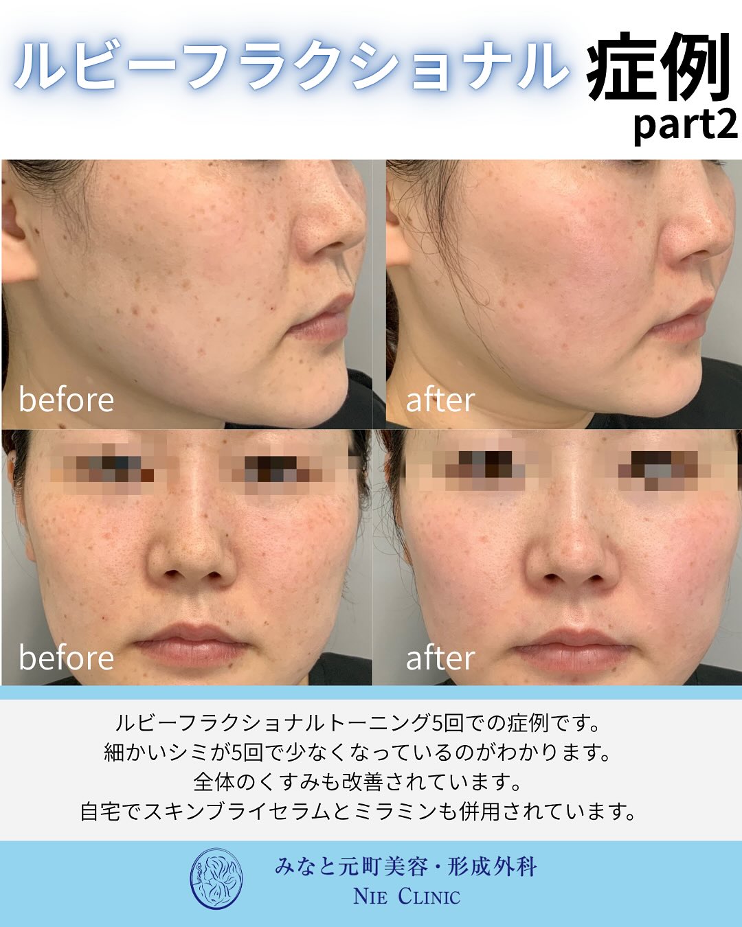 ルビーフラクショナルのご紹介