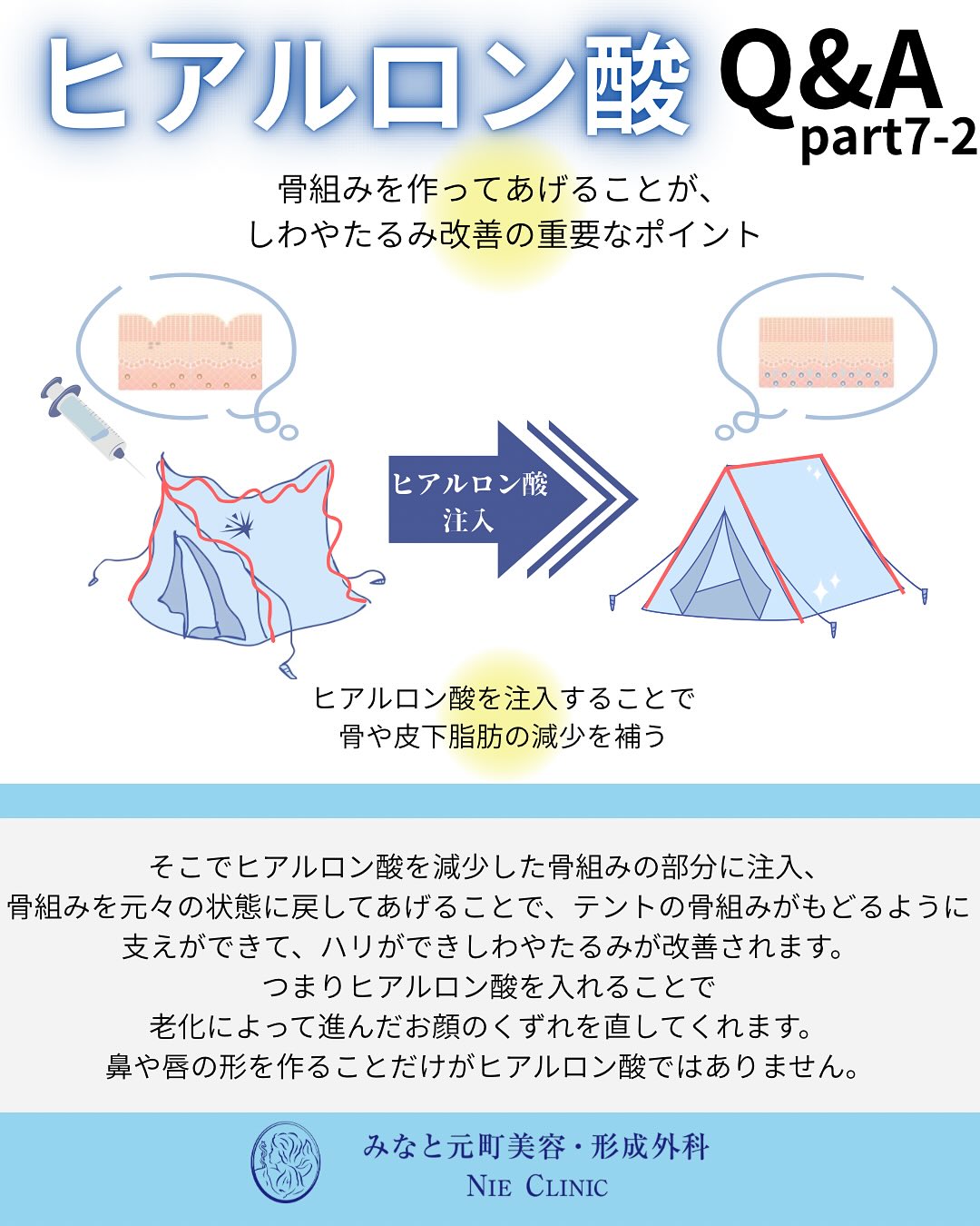 ヒアルロン酸のよくある質問