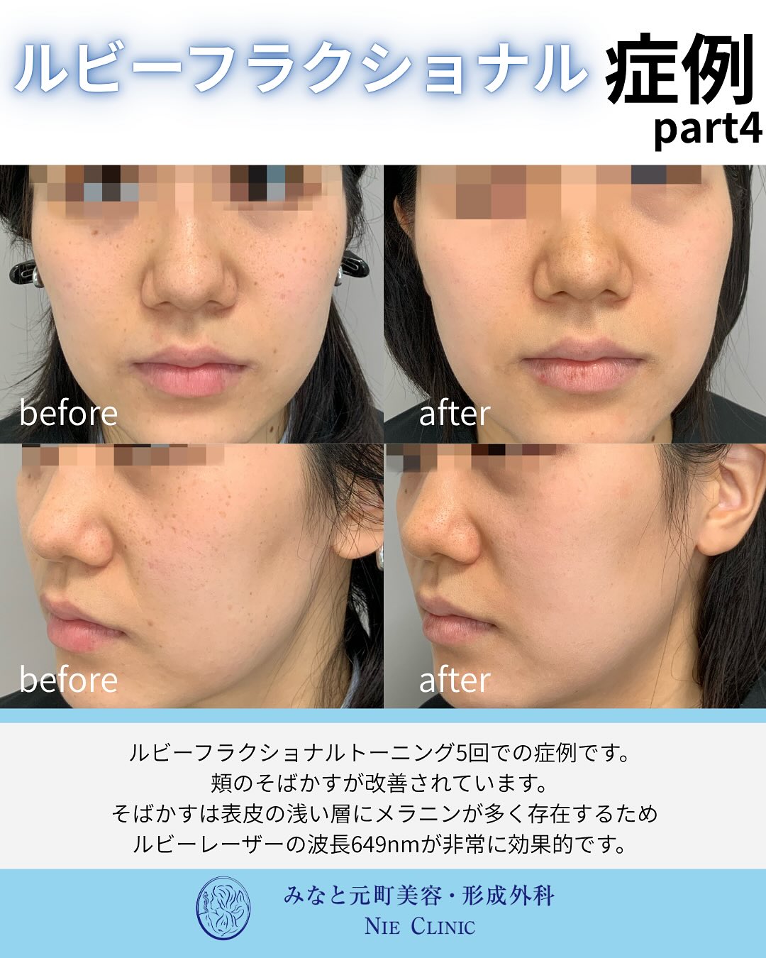 ルビーフラクショナルのご紹介