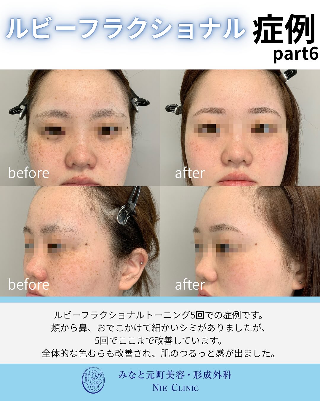 ルビーフラクショナルのご紹介