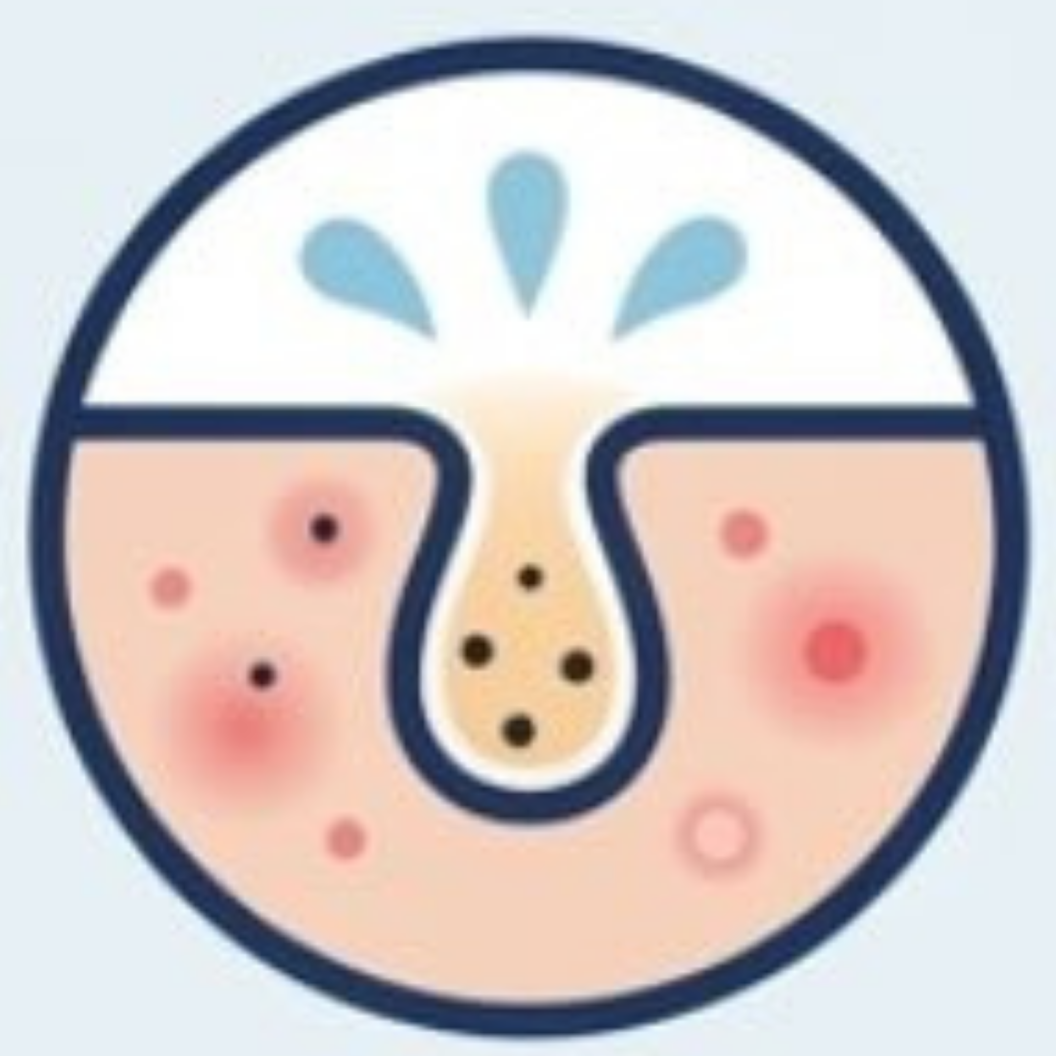 皮脂型毛穴のイメージ