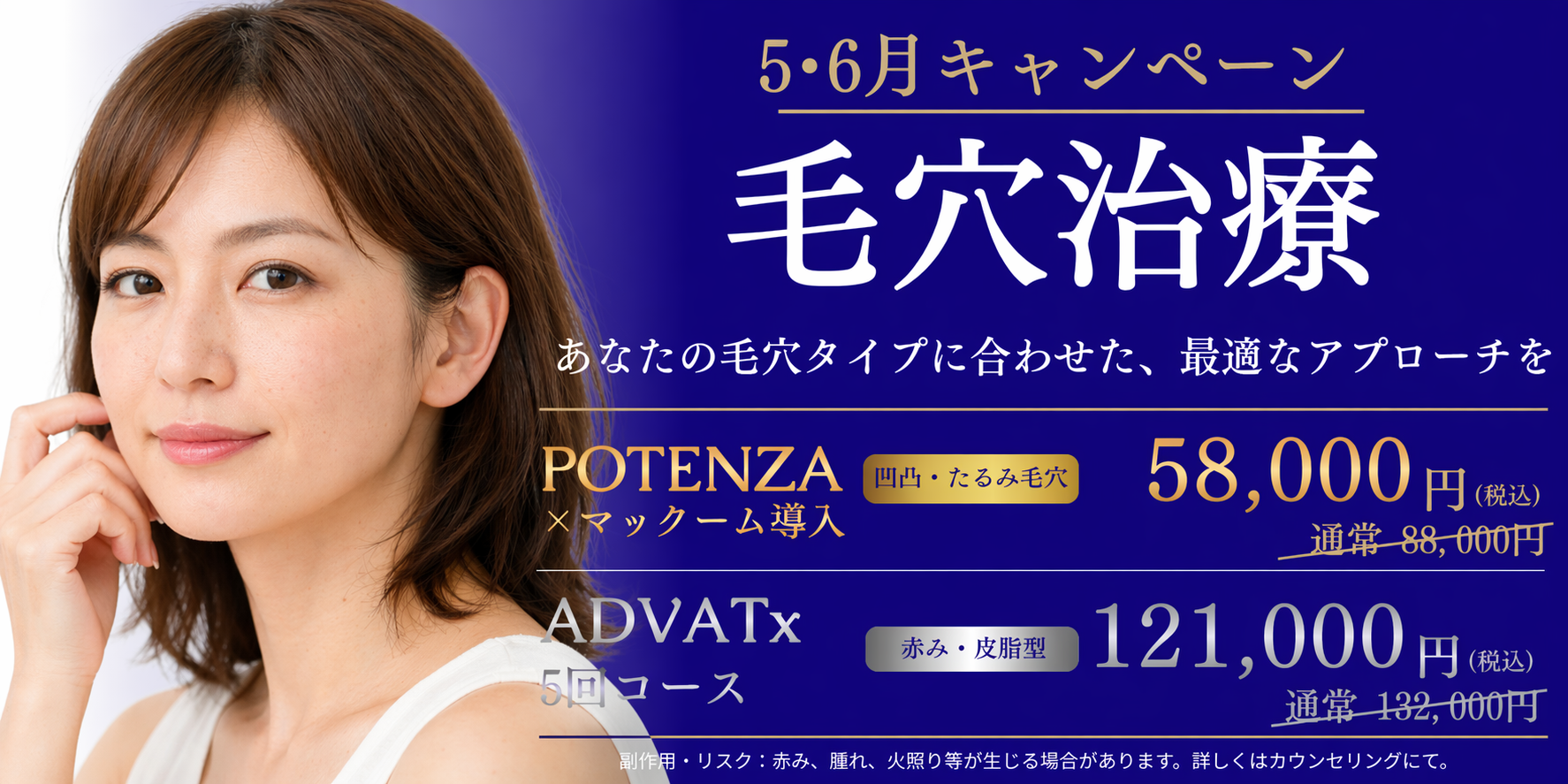 毛穴治療のキャンペーンバナー