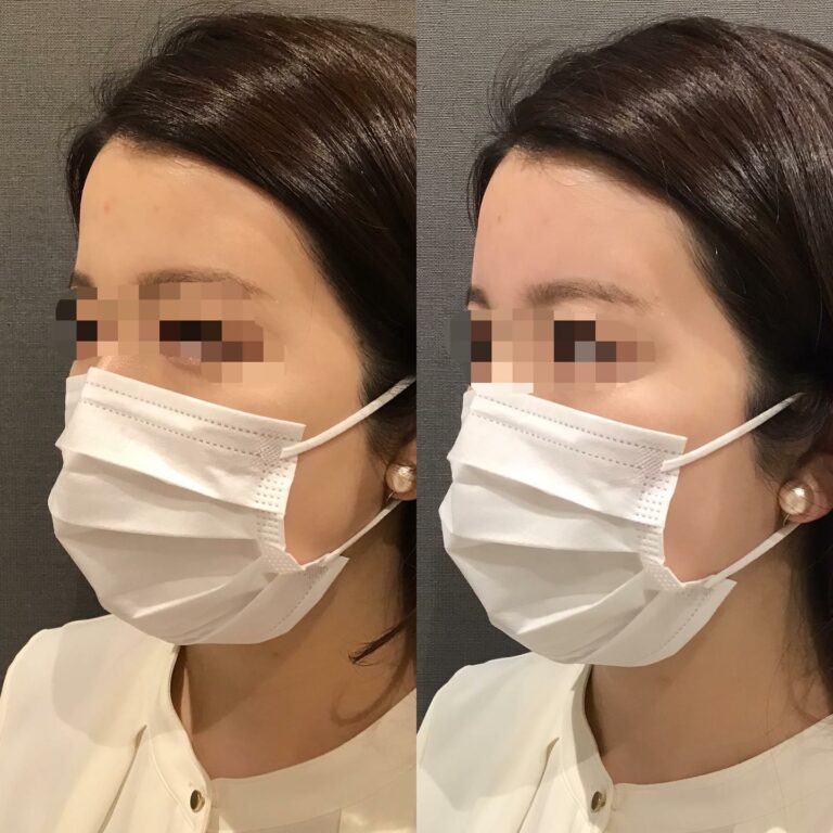 instagram-01-113