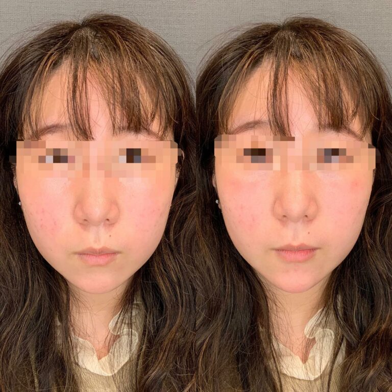 instagram-01-120