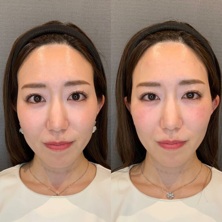 instagram-01-130