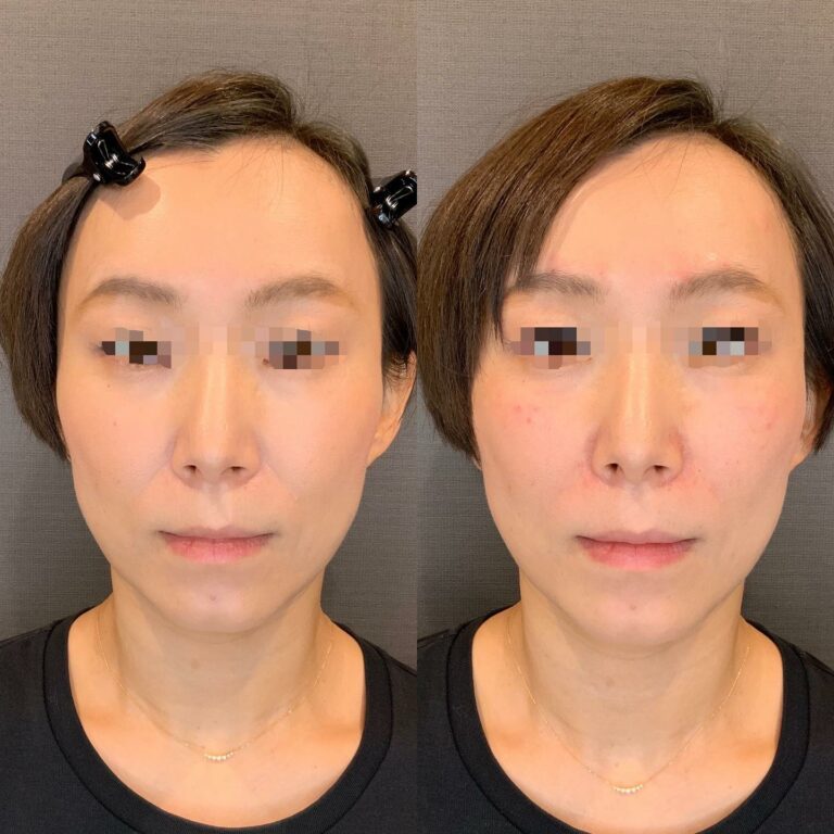instagram-01-141