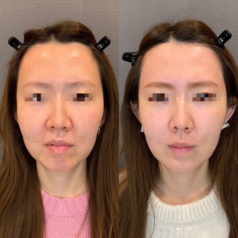 instagram-01-145