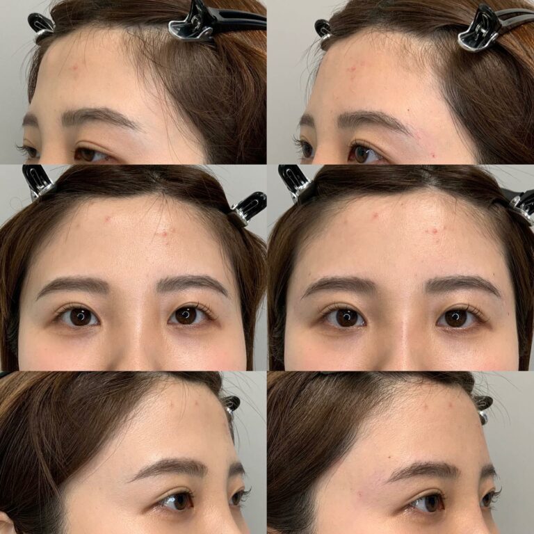 instagram-01-172