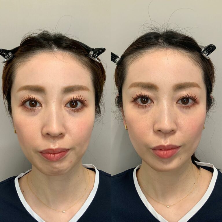 instagram-01-204