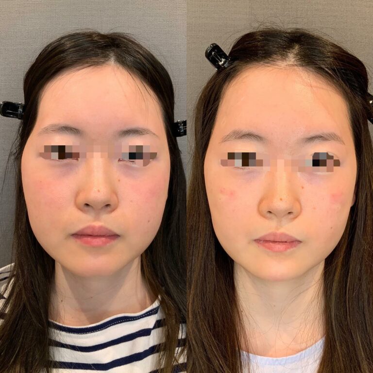 instagram-01-208