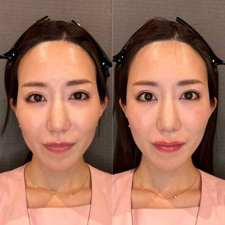 instagram-01-230