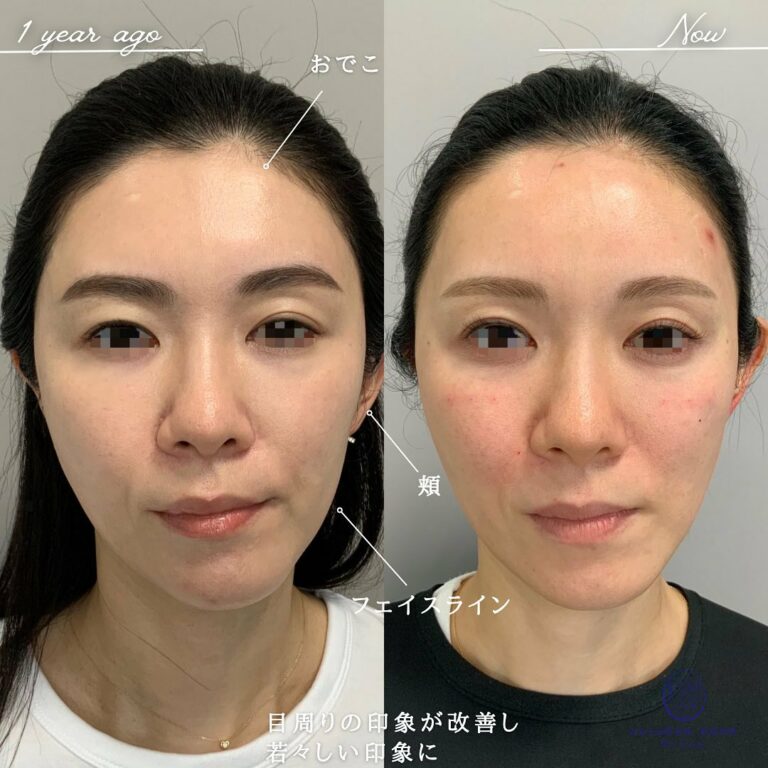 instagram-01-278